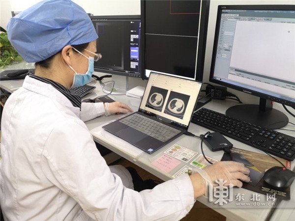 코로나19 감염 CT 이미지 자동 분석 시스템이 일선 병원 현장에서 시범 사용되는 모습, 사진제공=동북넷(东北网)